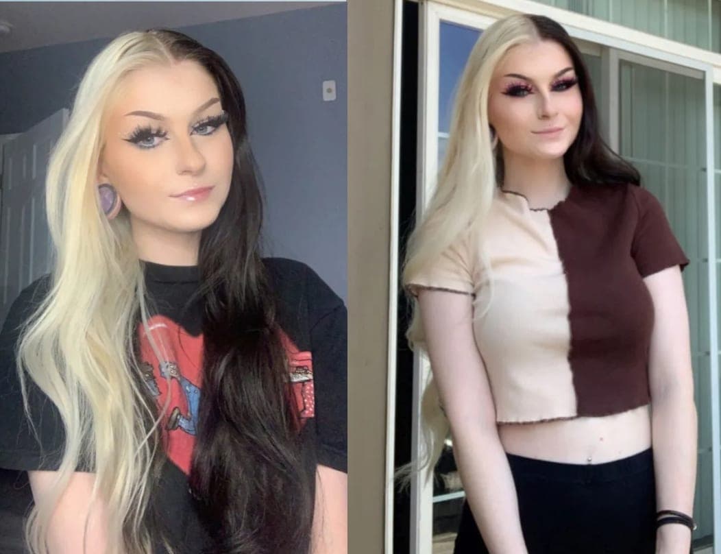 21 moteris turinti dvi gimdas tvirtina, kad seksas jai yra tarsi loterija