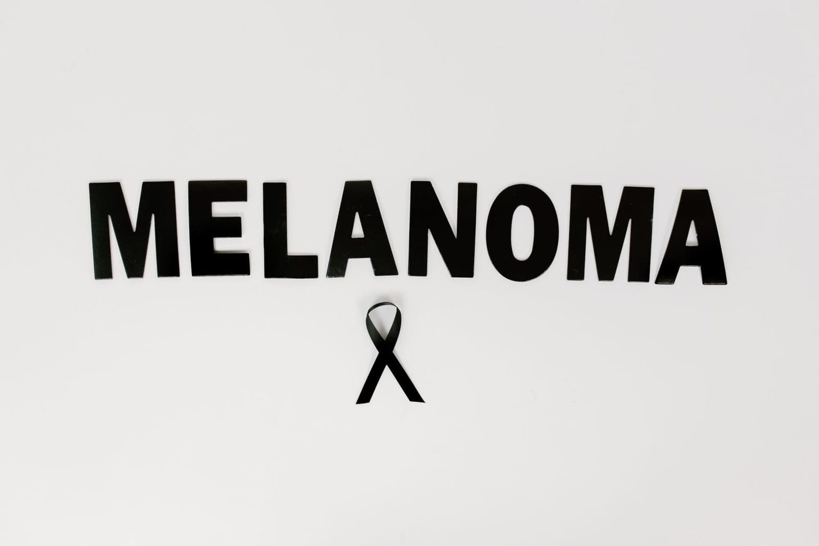 Mitai apie odos vėžį – melanomą