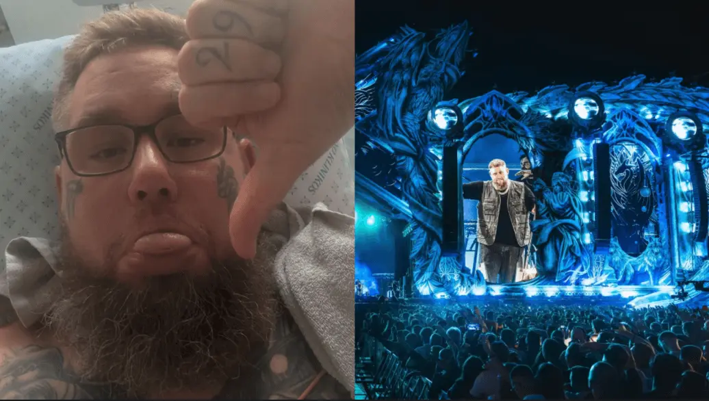 Rag‘n‘Bone Man guli Kauno klinikose: iš repeticijos išvyko su greitąja, atšaukė koncertą