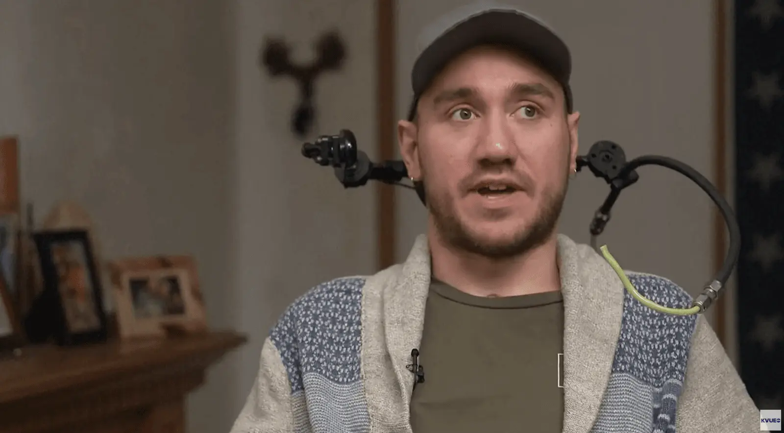 Vyras, su implantuotu mintis skaitančiu „Neuralink“ implantu: „ačiū E. Muskui“