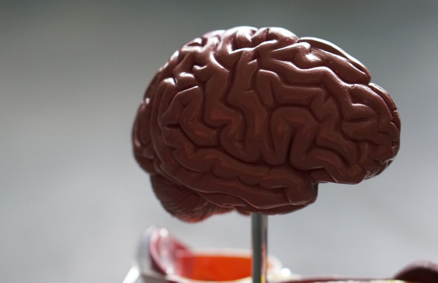 Alzheimerio liga