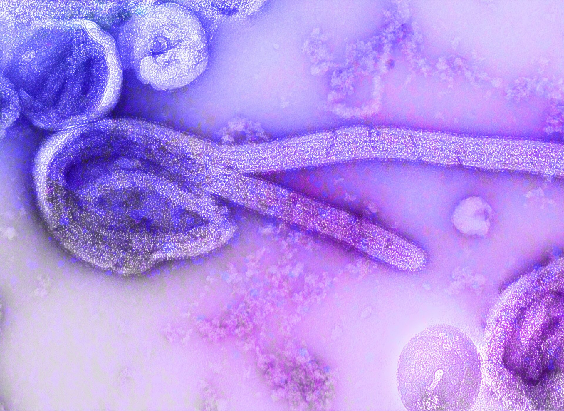 Ebolos virusas